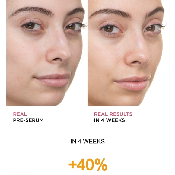 It Bye Bye Dullness 15% Vitamin C - Picture 3 of 6